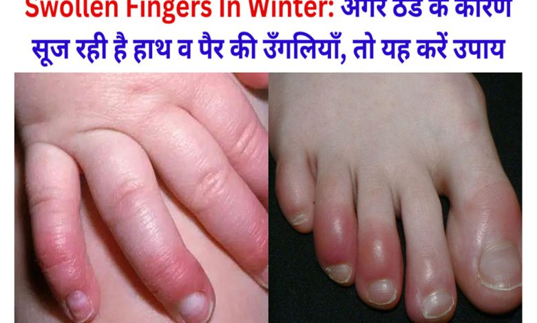 Swollen Fingers In Winter