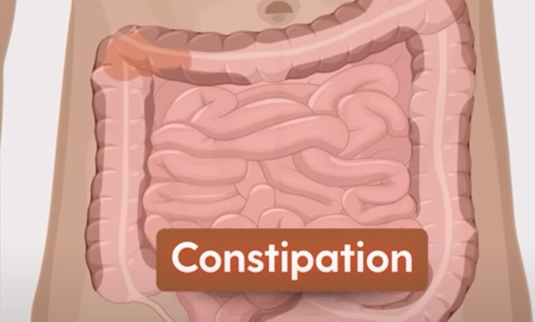 Constipation Home Remedies